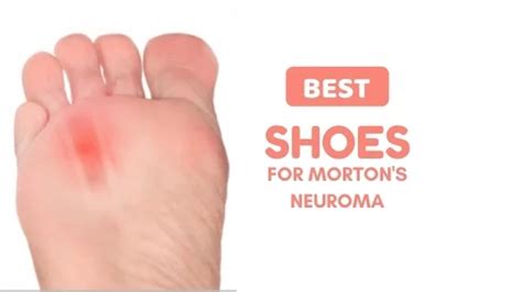 slippers for morton's neuroma relief.